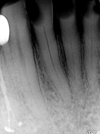 Mr gayet kky88d - Eugenol