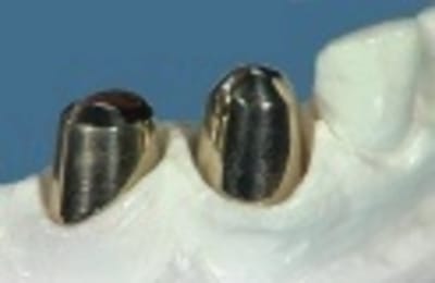 Muster innenteile klein lzzp67 - Eugenol