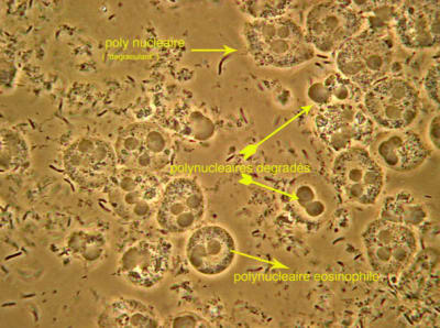Neutrophiles ar2cy1 - Eugenol
