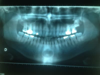 Nicolas pano pcu0w3 - Eugenol