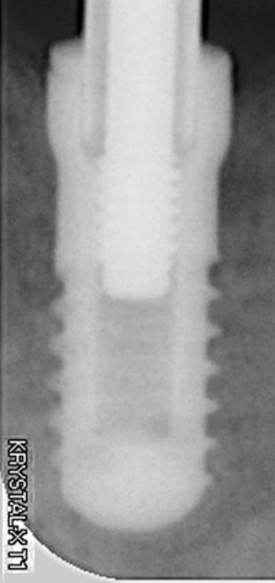 Onb cmmvuv - Eugenol