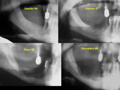 Onm altgzx - Eugenol