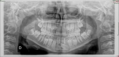 Opt d66hcm - Eugenol