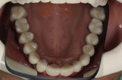 Osapres x220xu - Eugenol