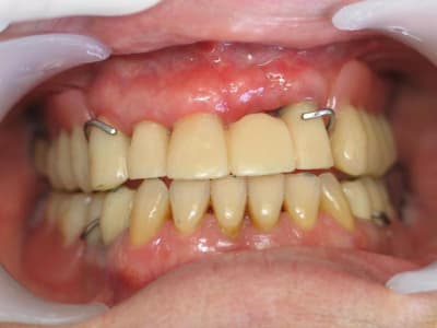 Ouf y4lwdi - Eugenol