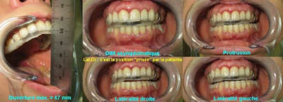 Occlusodontologie 03 wglkbk - Eugenol