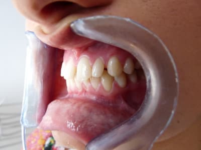 P1000264 sltmnl - Eugenol