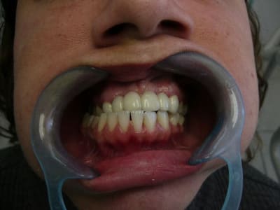 P1010503 itgxtl - Eugenol