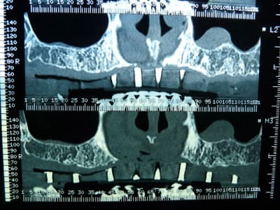 P1050010 cyqmij - Eugenol