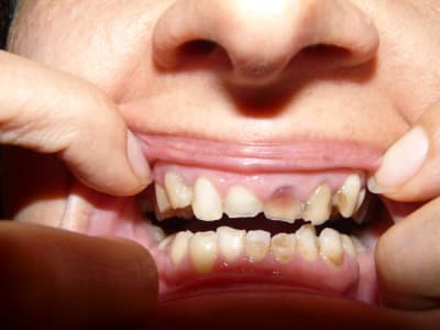 P1070083 asqpiv - Eugenol