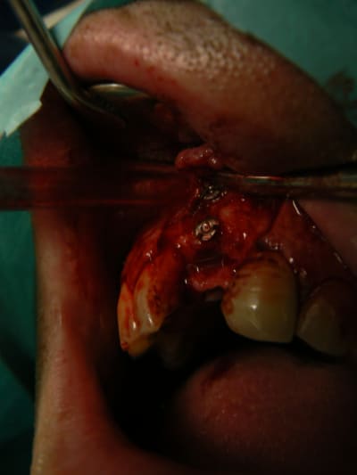 P1090040 yinqqy - Eugenol