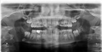 P1 f vz1gy9 - Eugenol