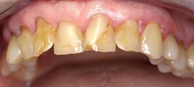 P2166557   copie lyyn4j - Eugenol