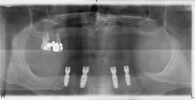 Pano1 dlihka - Eugenol