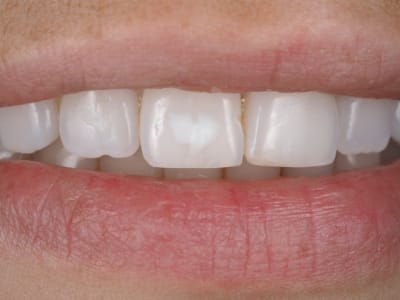 Pb070646  2  s7bdim - Eugenol