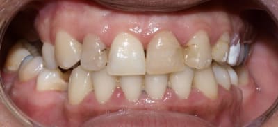 Pb140619 tflgqm - Eugenol