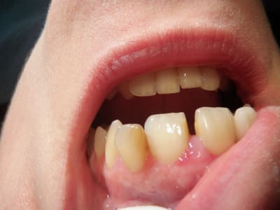 Pc220011 vbthck - Eugenol