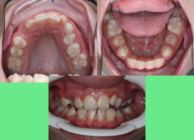 Photos 1 ma5cy1 - Eugenol