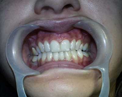 Pic00036 ba5wza - Eugenol