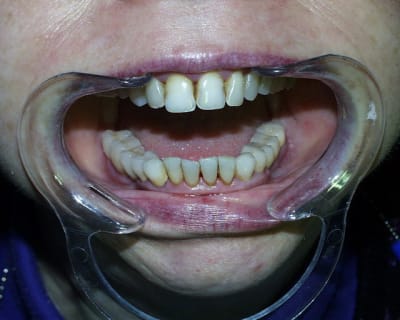 Pic00057 yujktp - Eugenol