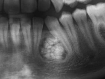 Pict0005 ktk18a - Eugenol