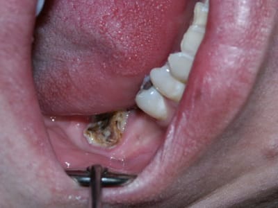 Pict0021 gvrjzd - Eugenol