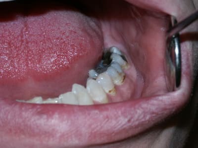 Pict0023 taujiy - Eugenol