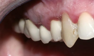 Pict0031 xgf928 - Eugenol