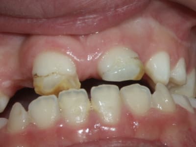 Pict0173 fmwrzg - Eugenol