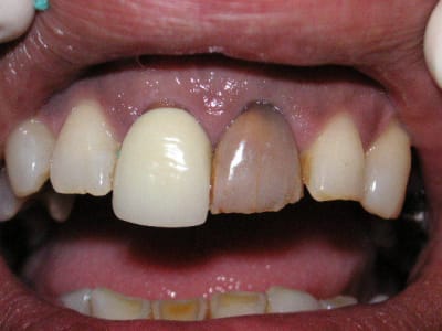 Pict0242 xkee3u - Eugenol