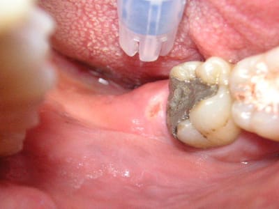 Pict0248 vzgvzz - Eugenol