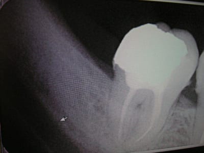 Pict0250 ebhmpm - Eugenol