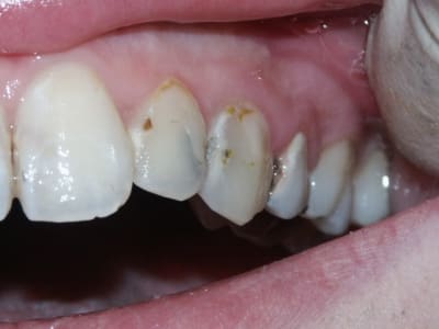 Pict0335 y43rwl - Eugenol