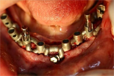 Positdental 1 f2uwop - Eugenol