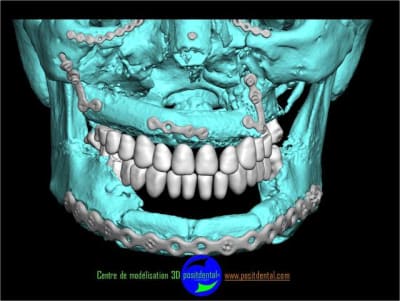 Positdental 4 kf3rkq - Eugenol