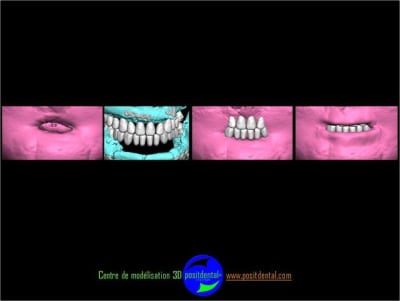 Positdental 8 fiq0dh - Eugenol