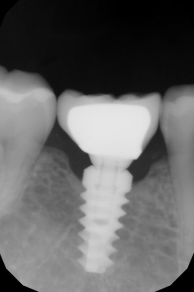 Pano 46  1  h05wid - Eugenol
