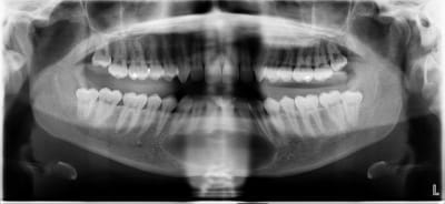 Pano k1ssm5 - Eugenol