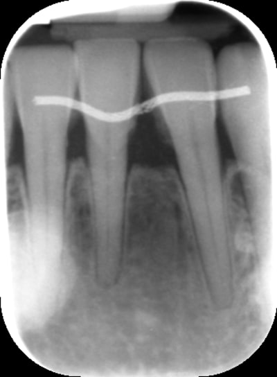 Pastedgraphic 2 hmuads - Eugenol