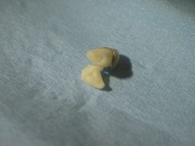 Photo34 005 st7i6t - Eugenol