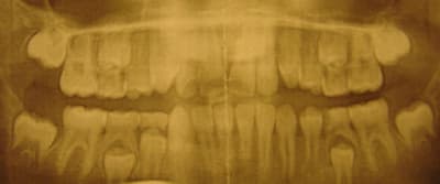 Photo 002 houdhp - Eugenol