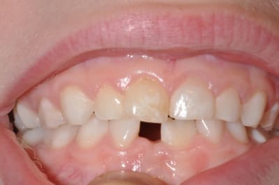 Photo 002 nb9fgy - Eugenol