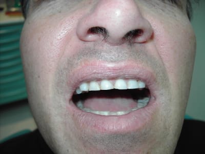 Photo 005 etae3i - Eugenol