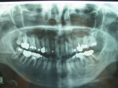 Photo 008 hhfgpt - Eugenol