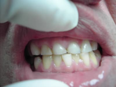 Photo 009 auz9uh - Eugenol