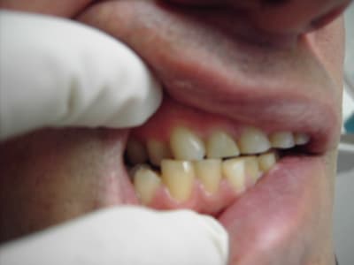 Photo 012 j8bmox - Eugenol