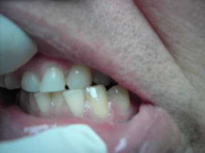 Photo 013 zrpeyw - Eugenol