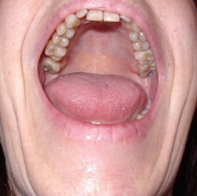 Photo 069 tecdms - Eugenol