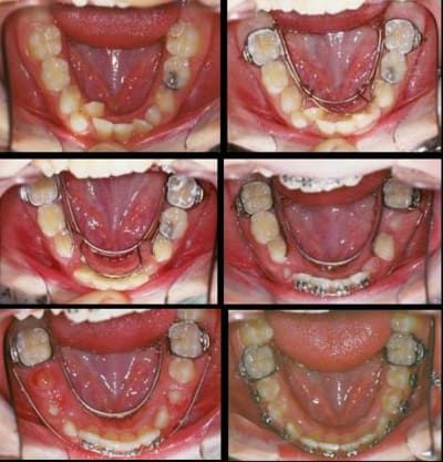Picture aaa sdfvru - Eugenol