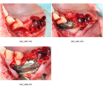 Planche contact 003 lzsprm - Eugenol